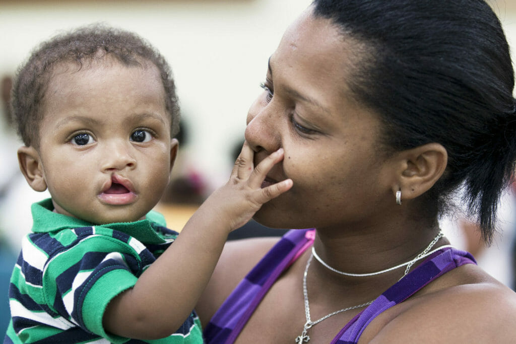 049, Edgard Fulcar had his surgery during the La Romana mission in 2012, when he has 9 months old. Santo Domingo, Dominican Republic. (Operation Smile Photo - Carlos Rueda)