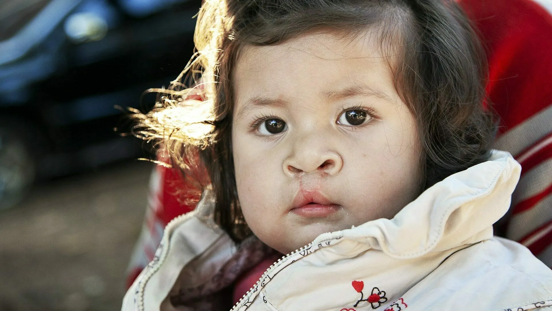 065, Brenda Lujan Brizuela Alfonso, 1 year , Female, UCL/CP, After, 7 hours by bus. On the screening on his father's Jose lap. First surgery in March 2016. Operation Smile, Asuncion, Paraguay, September 10 to September 17, Hospital Militar Central de Sajonia. (Operation Smile Photo - Paulo Fabre)