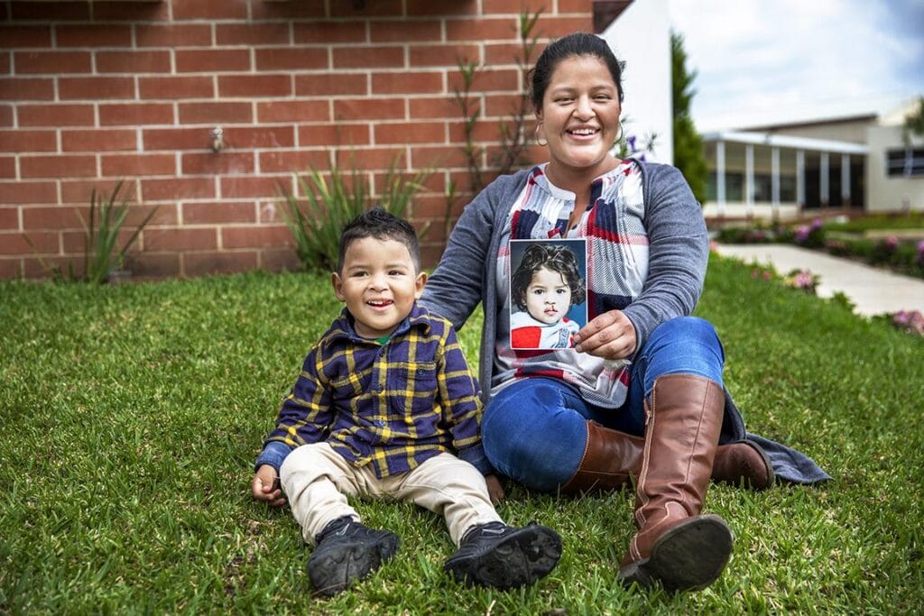Dilan Isaac Lópex sentado junto a su madre en la grama con la foto del antes de la intervención de Operation Smile