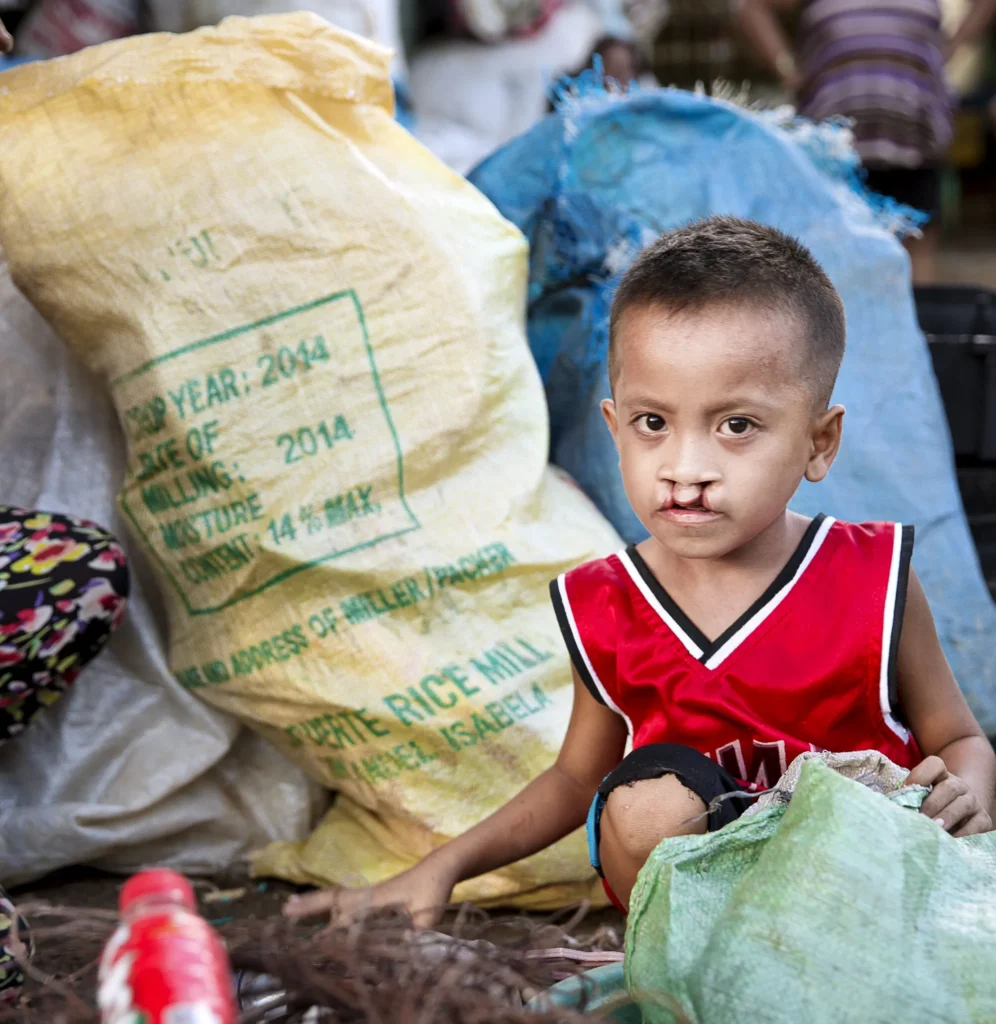 PHL 2015 Cebu 023 Joseph Before 037 2000x3000 e95106e aspect ratio 2000 2057