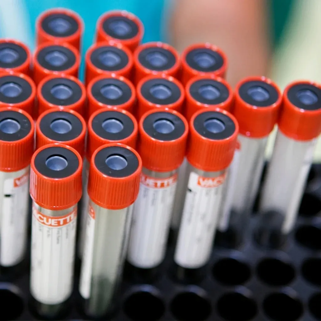 Muestras para laboratorio